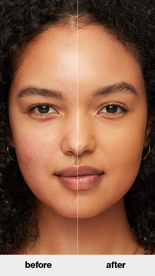 dehydrated skin before and after